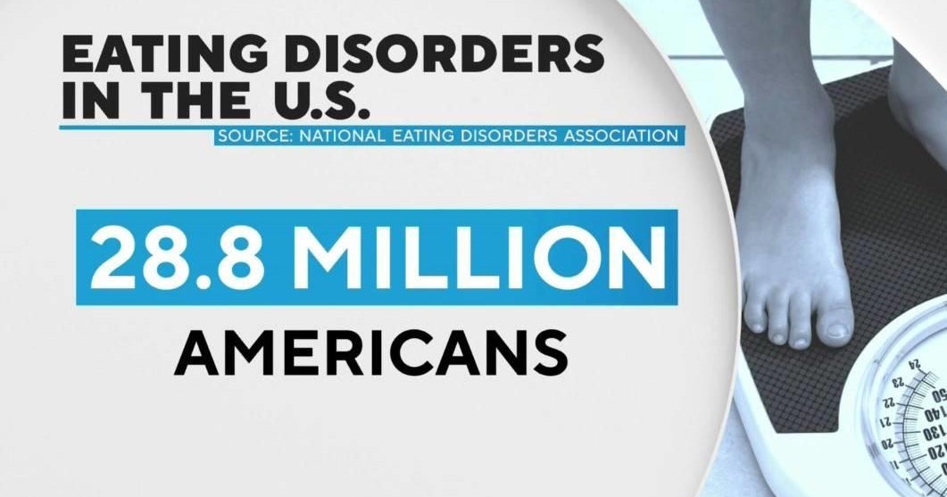 Mental health counselor says eating disorders are far more common in