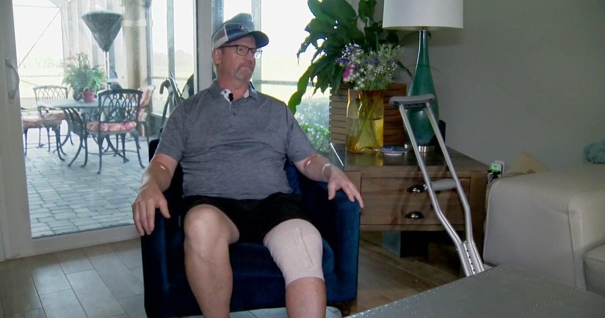 Florida male attacked by alligator right after hearing sound, opening front doorway