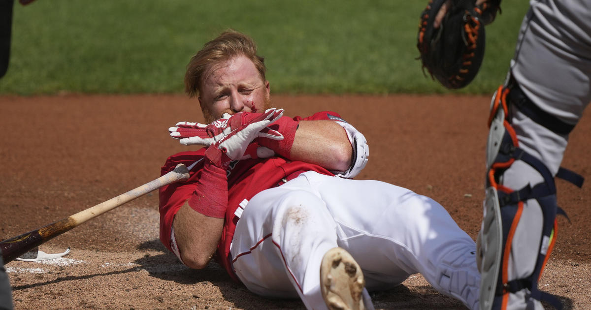 Red Sox's Justin Turner hit in face during spring training