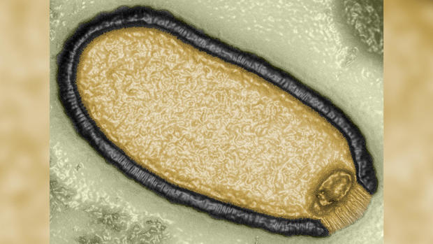 Microphoto of 'zombie' virus 