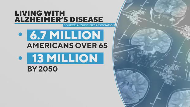 alzheimers-disease-graphic.jpg 