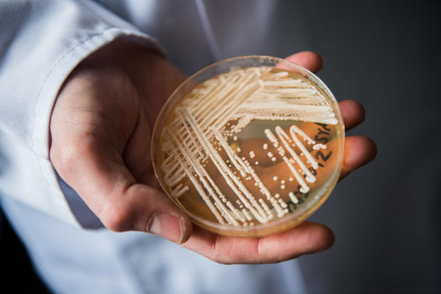 Petri dish of Candida auris fungus 