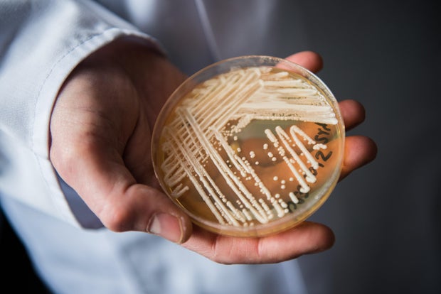 Petri dish of Candida auris fungus