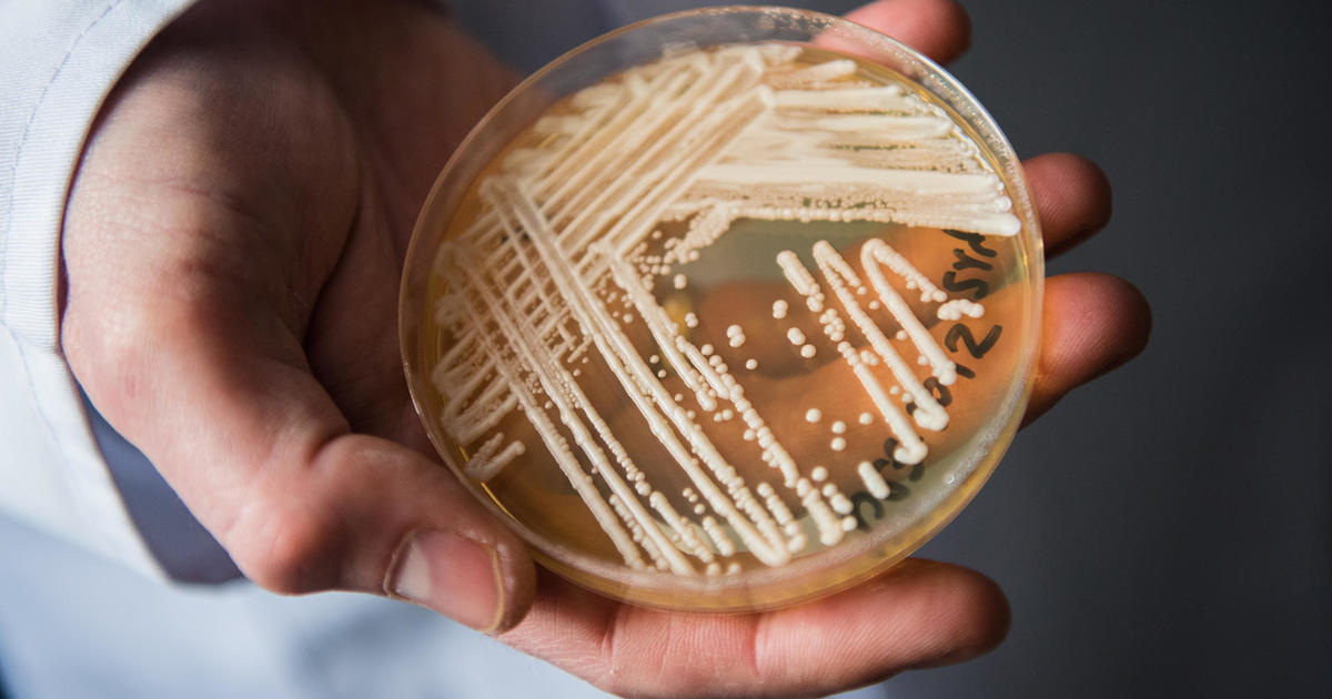 Candida auris: Nevada, California’s Leading Superbug Infection Countries