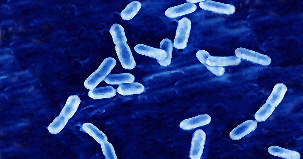 Rizo-López Foods cheese and dairy products recalled after deadly listeria outbreak Rizo-López Foods cheese and dairy products recalled after deadly listeria outbreak