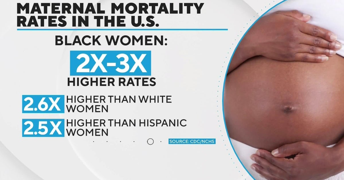Black Women Dying From Pregnancy related Causes At Significantly Higher black-women-dying-from-pregnancy-related-causes-at-significantly-higher