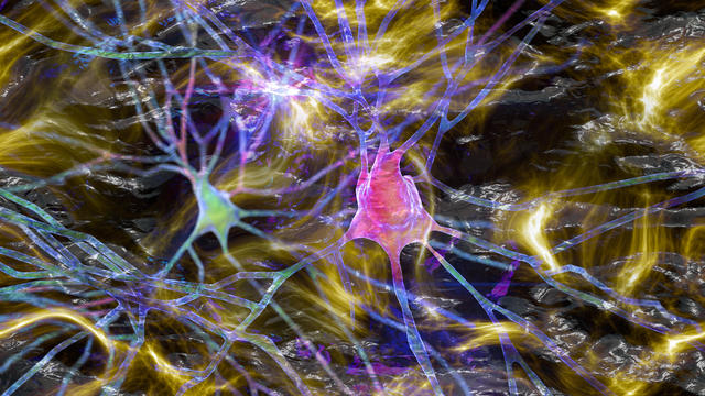 Neurons in dementia, conceptual illustration 