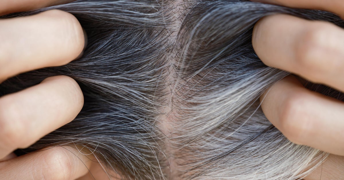 New study sheds light on what makes hair turn grey - CBS Boston