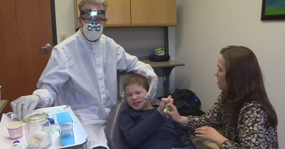 Dentist offers "no drill" cavity treatment alternative for kids with disabilities CBS Minnesota