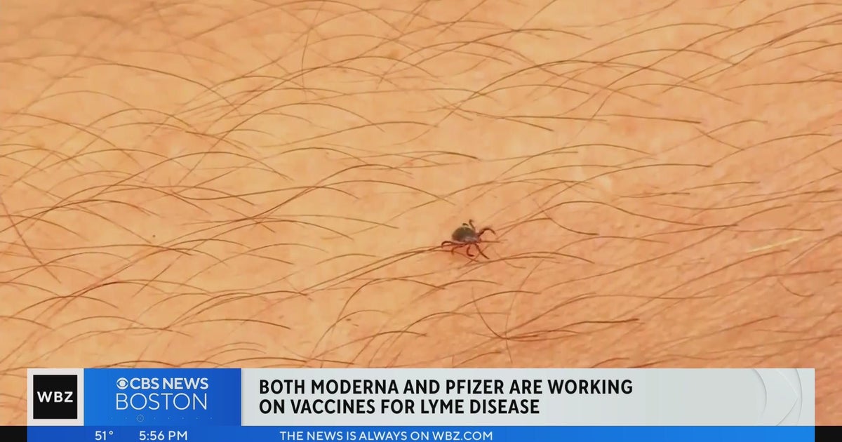 lyme-disease-vaccines-in-the-works-at-moderna-pfizer-cbs-boston