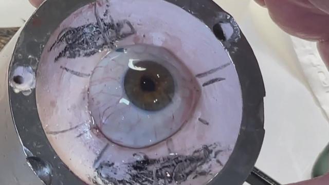 How glassmaker's incredibly realistic prosthetic eyes are giving hope to  victims of trauma, illness and accidents