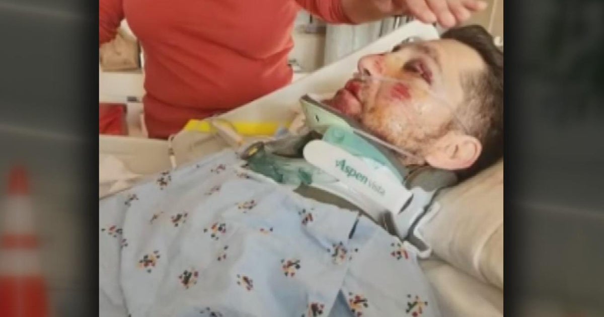Road worker hit by carjacking suspect on Vacaville freeway now home recovering