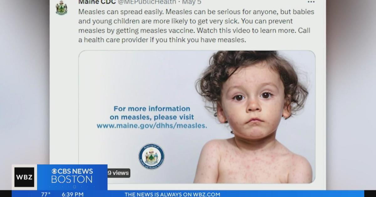 Maine confirms first case of measles since 2019