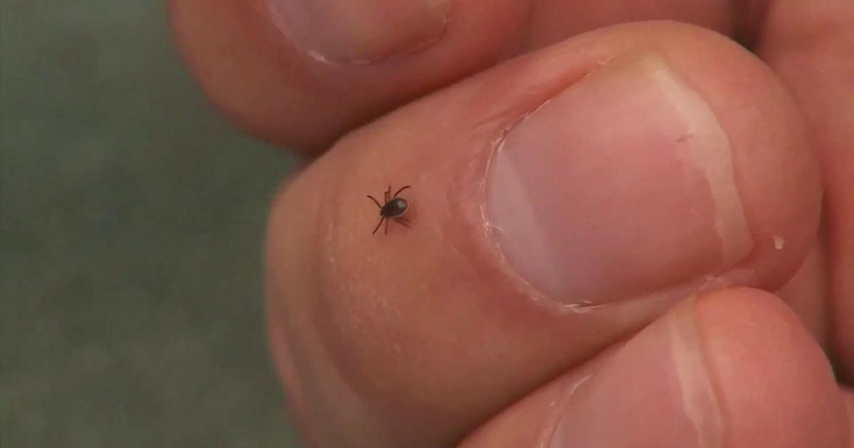 Potentially life-threatening tickborne disease showing up in Minnesota