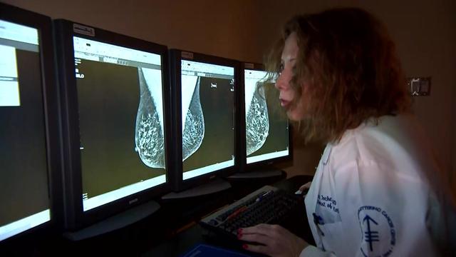 A doctor sits at a computer looking at mammogram screenings. 