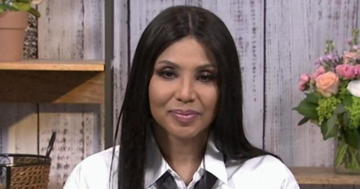 Toni Braxton has lived with lupus for 15 years. Here's what to know about the disease.
