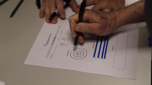 A patient with essential tremors draws a shaky spiral on a test paper at a hospital. 