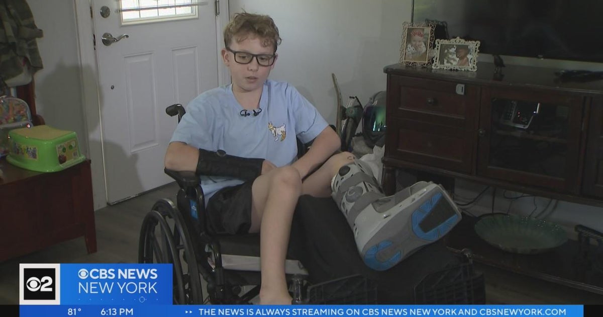 11-year-old boy recovering after being struck by car at East Islip ...