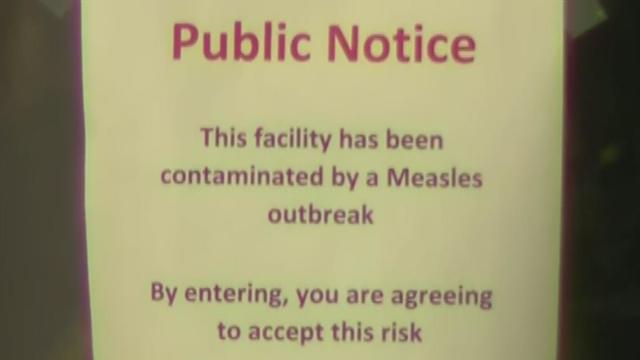 CPD Measles Outbreak 