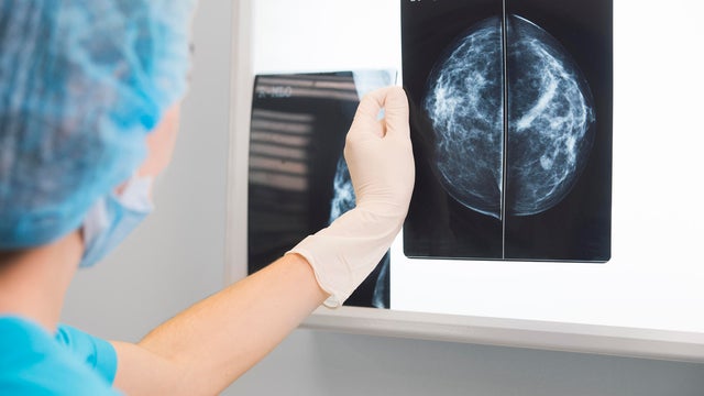 woman doctor or nurse in surgery outfit is holding a mammogram in front of x-ray illuminator 