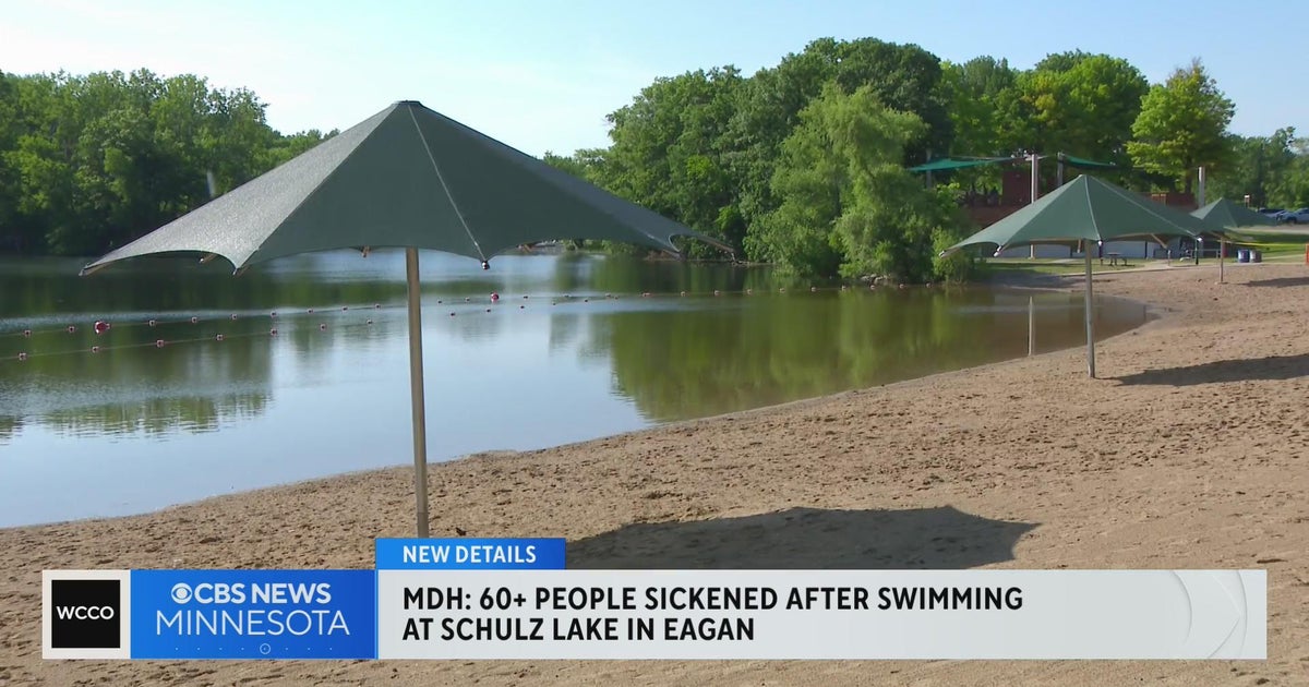 Outbreak at Schulze Lake in Eagan may be due to norovirus, experts say