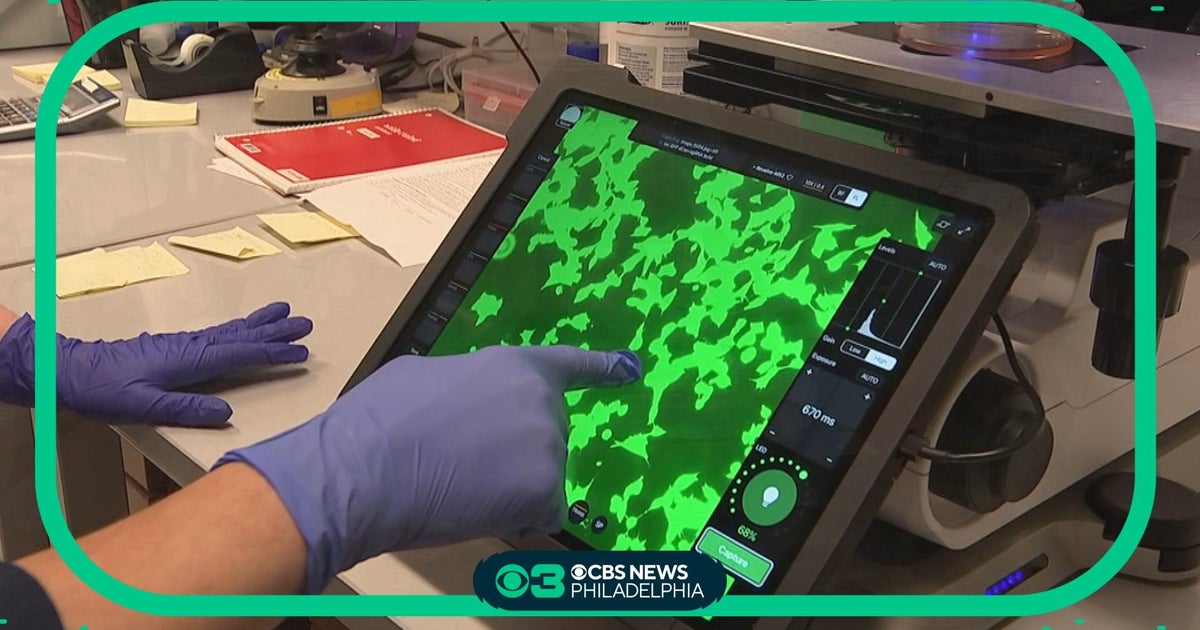 CHOP doctor makes strides in finding cure for "holy grail of childhood