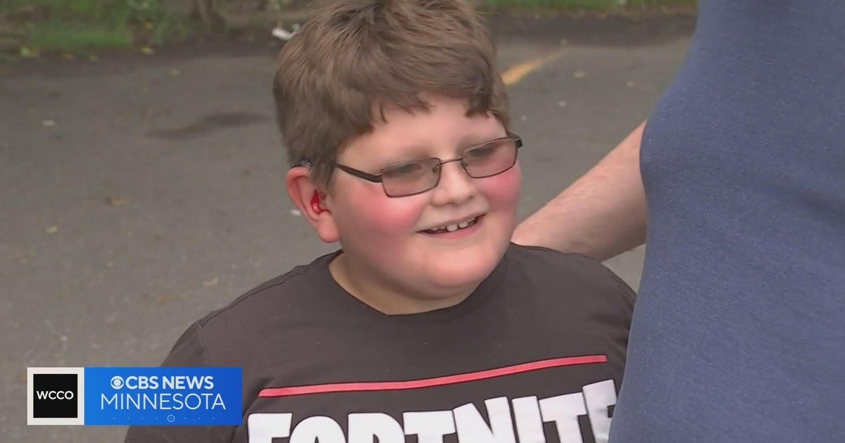Cruel prank leads to explosion of kindness - CBS Minnesota