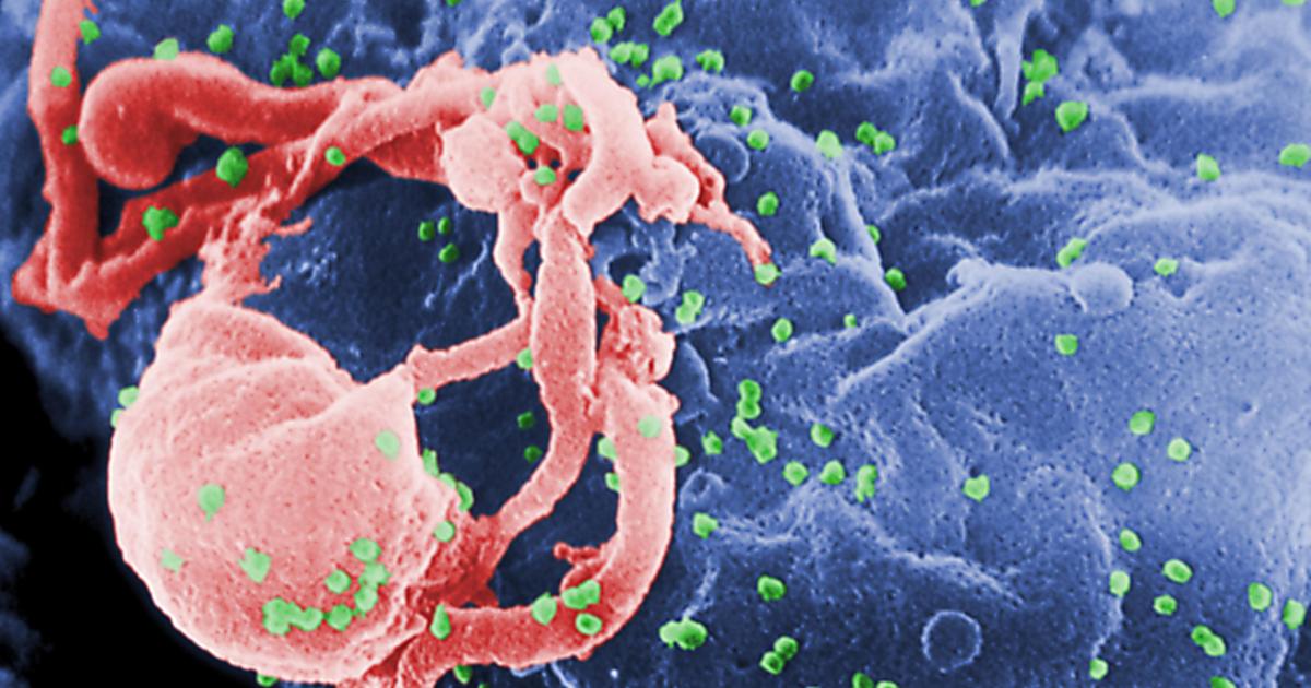 New HIV case linked to