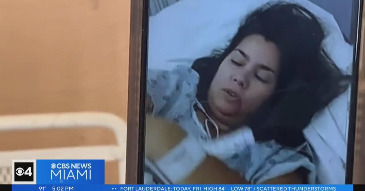 Woman attacked by two dogs in Miami neighborhood - CBS Miami