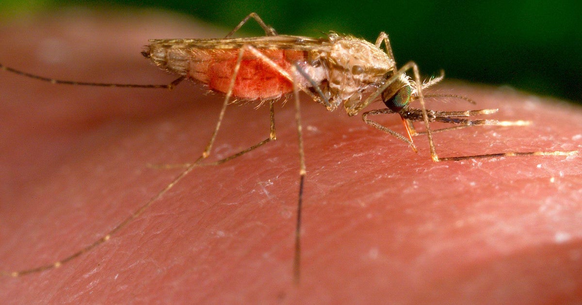 Situations of domestically acquired malaria rise to 6 in Florida