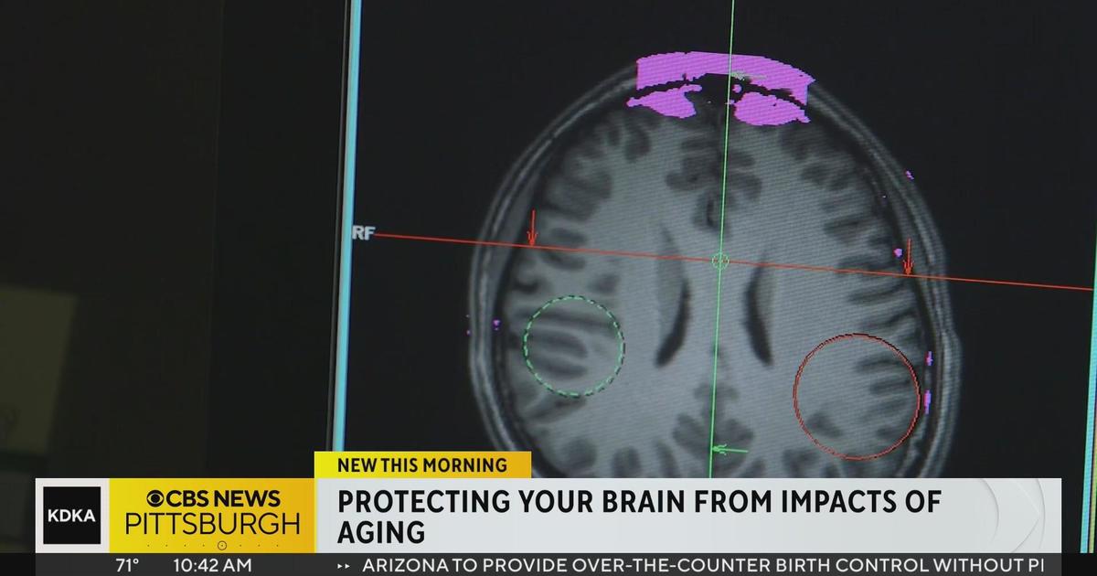 Protecting your brain from impacts of aging - CBS Pittsburgh