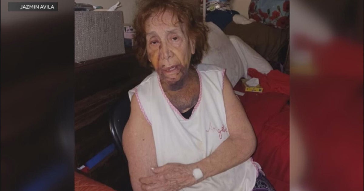 84-year-old beaten by serial assault suspect in East LA - CBS Los Angeles