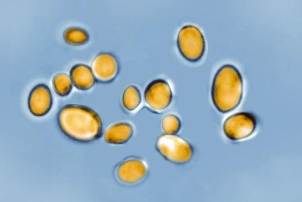 Candida auris, seen with an optical microscope, is a yeast responsible for many infections that's resistant to most antifungal drugs and has caused several deaths worldwide. 