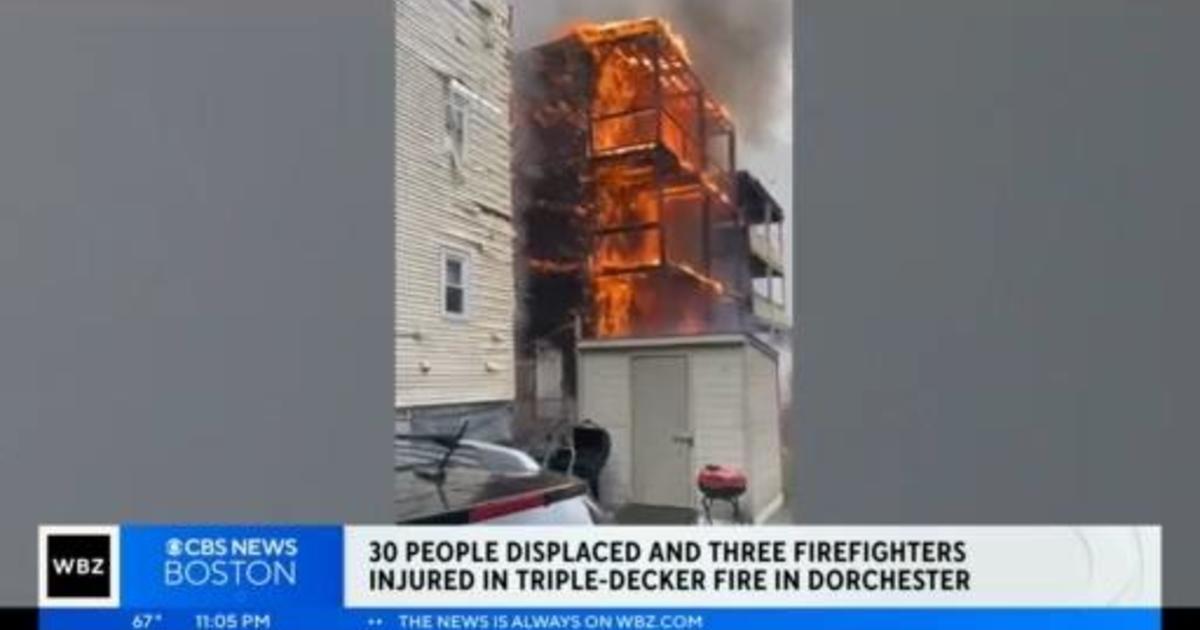 30 people displaced after fire in Dorchester