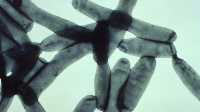 Legionella pneumophila bacteria 