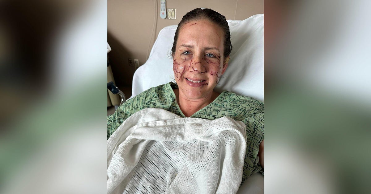 Woman attacked by ‘vicious’ otter: ‘I did not imagine I was likely to make it out of that river’ Woman attacked by ‘vicious’ otter: ‘I did not imagine I was likely to make it out of that river’