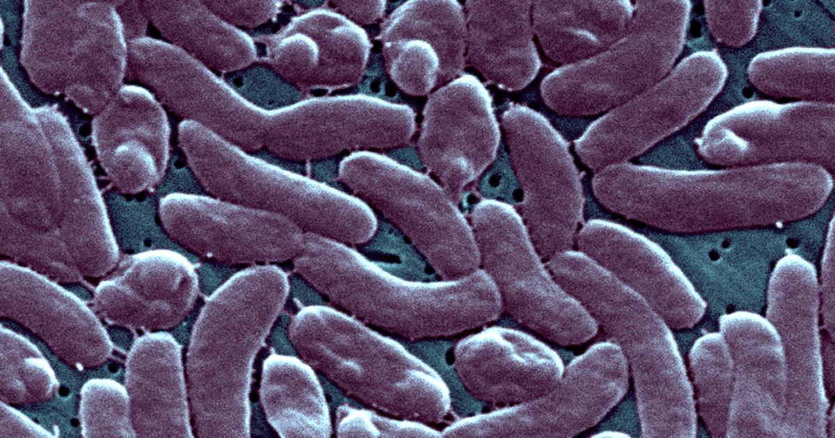 3 починали от рядка бактериална инфекция в района на Ню Йорк. Какво трябва да знаете за Vibrio vulnificus.