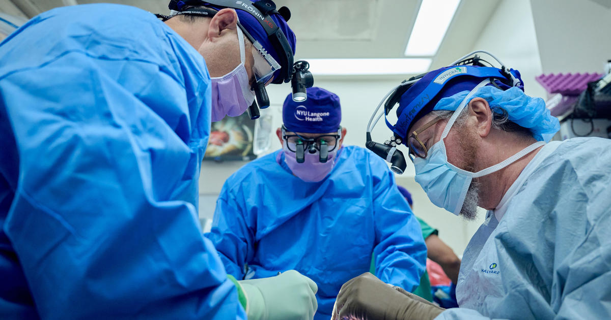 Свински бъбрек работи в дарено тяло за създаване на история 2 месеца, повдигайки надежда за трансплантации животно-човек: „Вълнение и облекчение“
