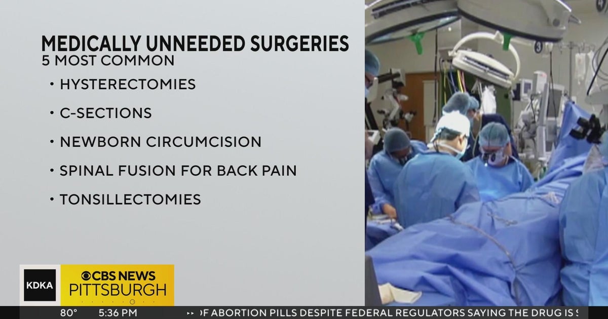 Money Minute: Spending too much on medically unneeded surgeries - CBS ...