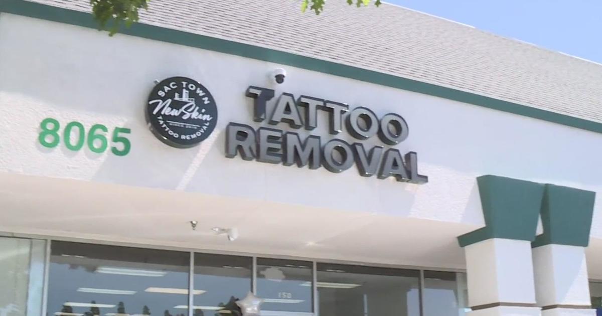 Hair & Tattoo Removal - Zeiva Professional Center