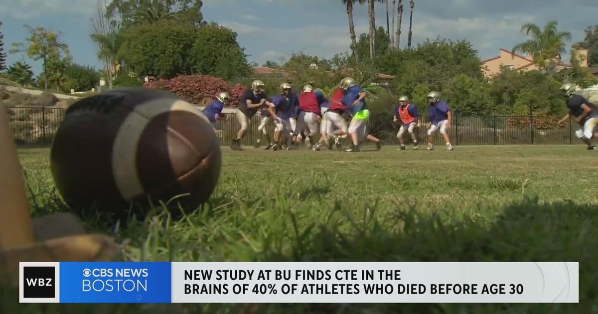 Young Amateur Athletes at Risk of CTE, BU Study Finds