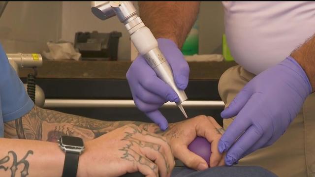 tattoo removal program for california inmates 