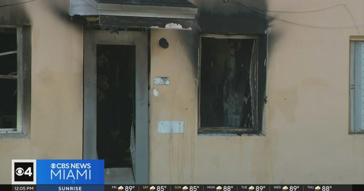 Lady severely burned in Miami condominium fire