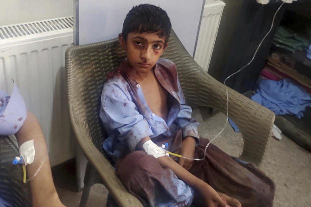 n this photo provided by the District Police Office, a boy injured in a bomb explosion receives treatment at a hospital in Mastung, near Quetta, Pakistan, Sept. 29, 2023
