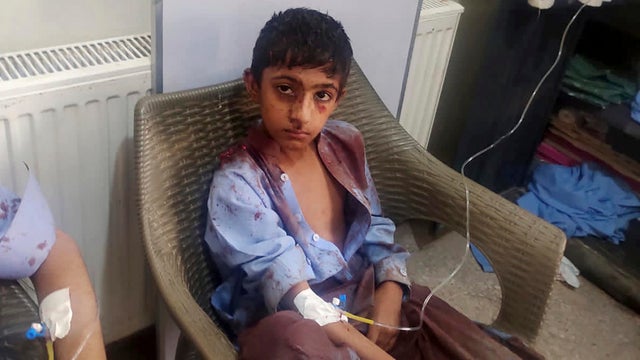 Pakistan Bombing 
