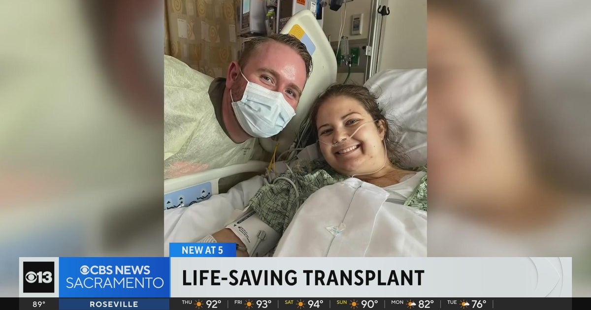 Modesto teacher, 27, gets life-saving heart transplant