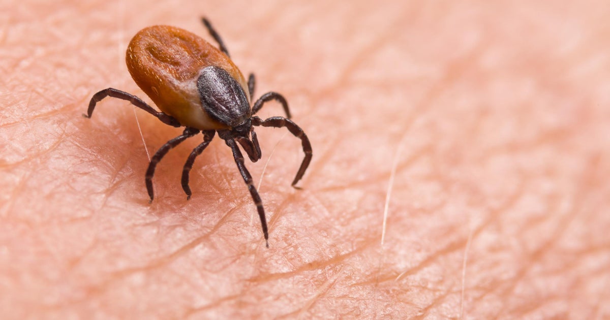 First travel-related death from rare tick-borne virus recorded in Maryland, health official says - Vimarsana News