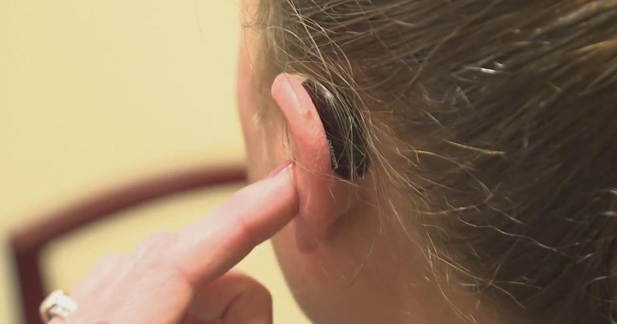 Pittsburgharea woman hears clearly for first time in years thanks to free hearing aid