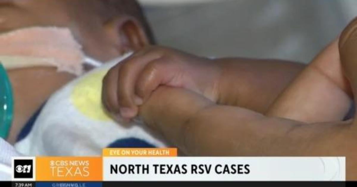 Rsv Cases Increase In North Texas Cbs Texas