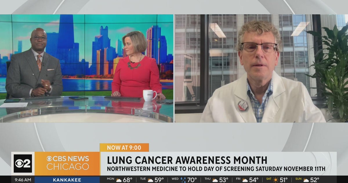 Northwestern Medicine hosting lung cancer screening day - CBS Chicago